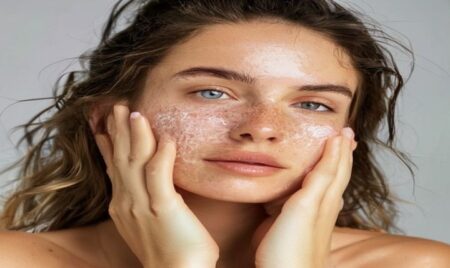 When Should You See Your Doctor about Acne?