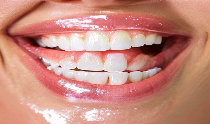 Top 6 Benefits of the Professional Teeth Whitening Top 6 Benefits of the Professional Teeth Whitening
