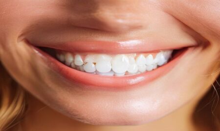 How Do Clear Aligners Work?